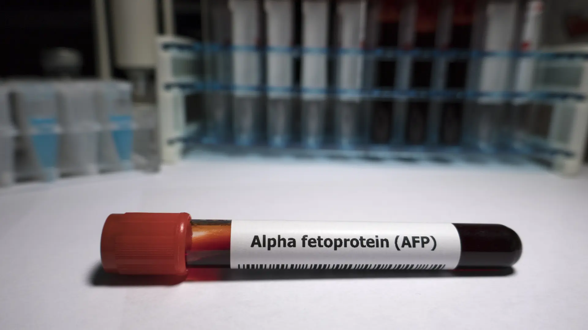 Alpha Fetoprotein